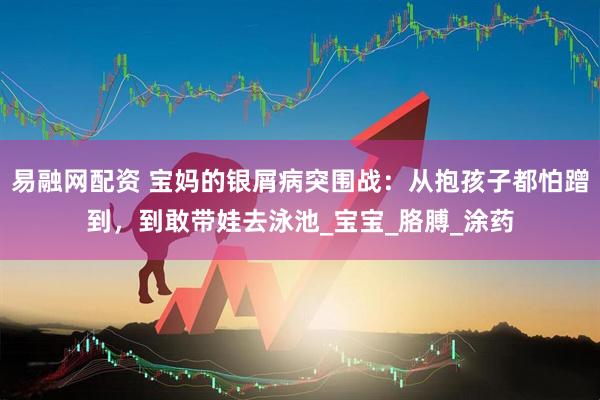 易融网配资 宝妈的银屑病突围战：从抱孩子都怕蹭到，到敢带娃去泳池_宝宝_胳膊_涂药